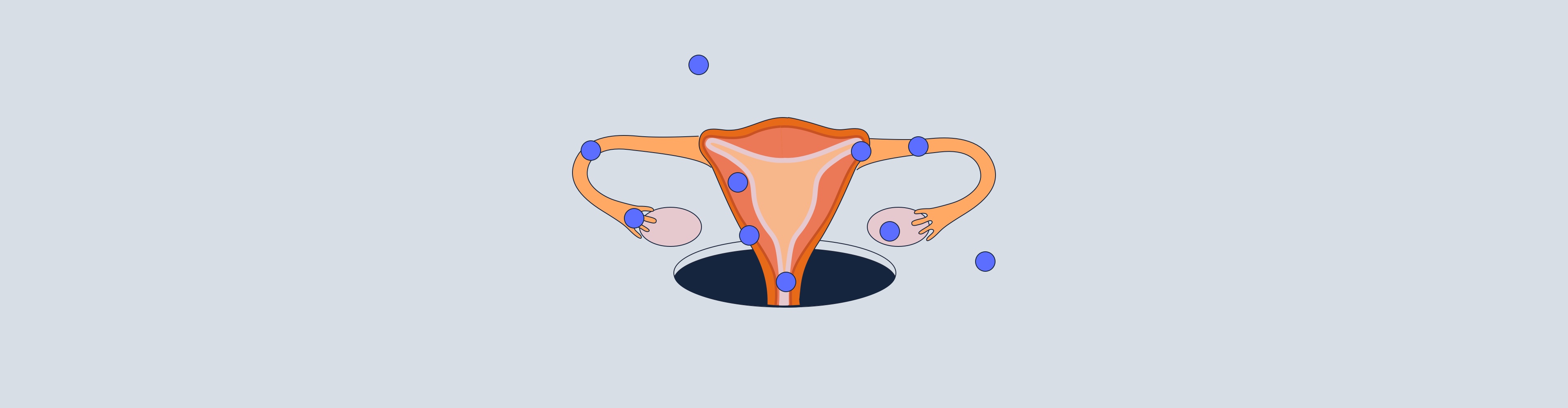 What Exactly Is An Ectopic Pregnancy?
